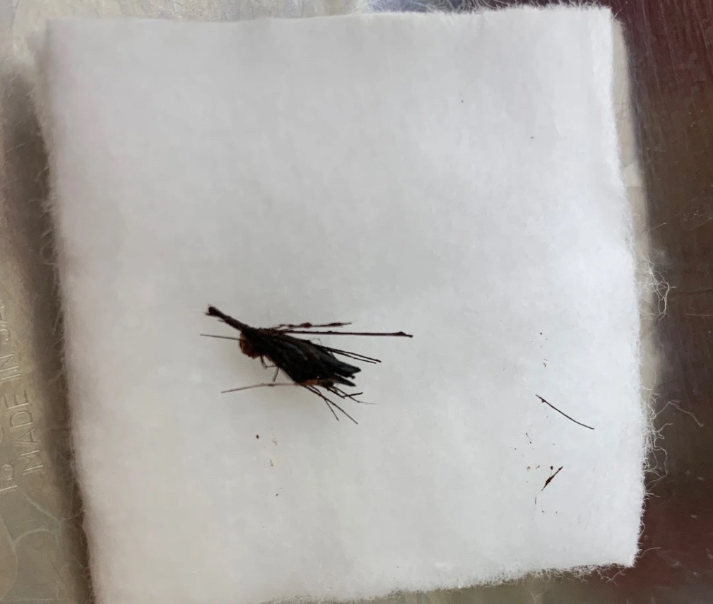 耳に草の実が入っていた症例