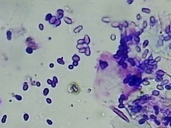 マラセチア皮膚炎の細胞診像。ピーナッツ状・雪だるま状の酵母様真菌がみられる